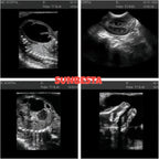 N50 Portable Veterinary Ultrasound Machine for Animal Pregnancy
