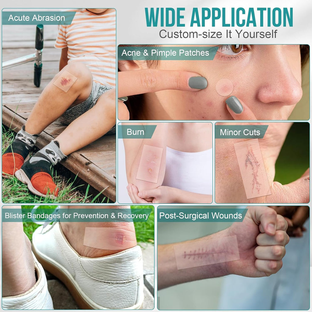Hydrocolloid Roll for Wound Care, Pimple Patch Roll Tape with Self-Adhesive, Bed Sore Bandages, Highly Absorbent for