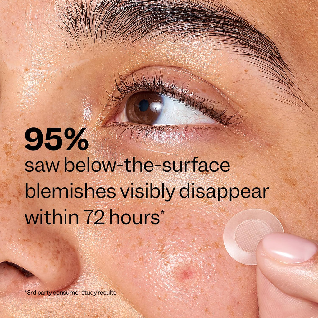 Deep Blemish Microdarts (9 ct) - Early Stage Pimple Patches for Face - Salicylic Acid, Niacinamide, Hyaluronic Acid
