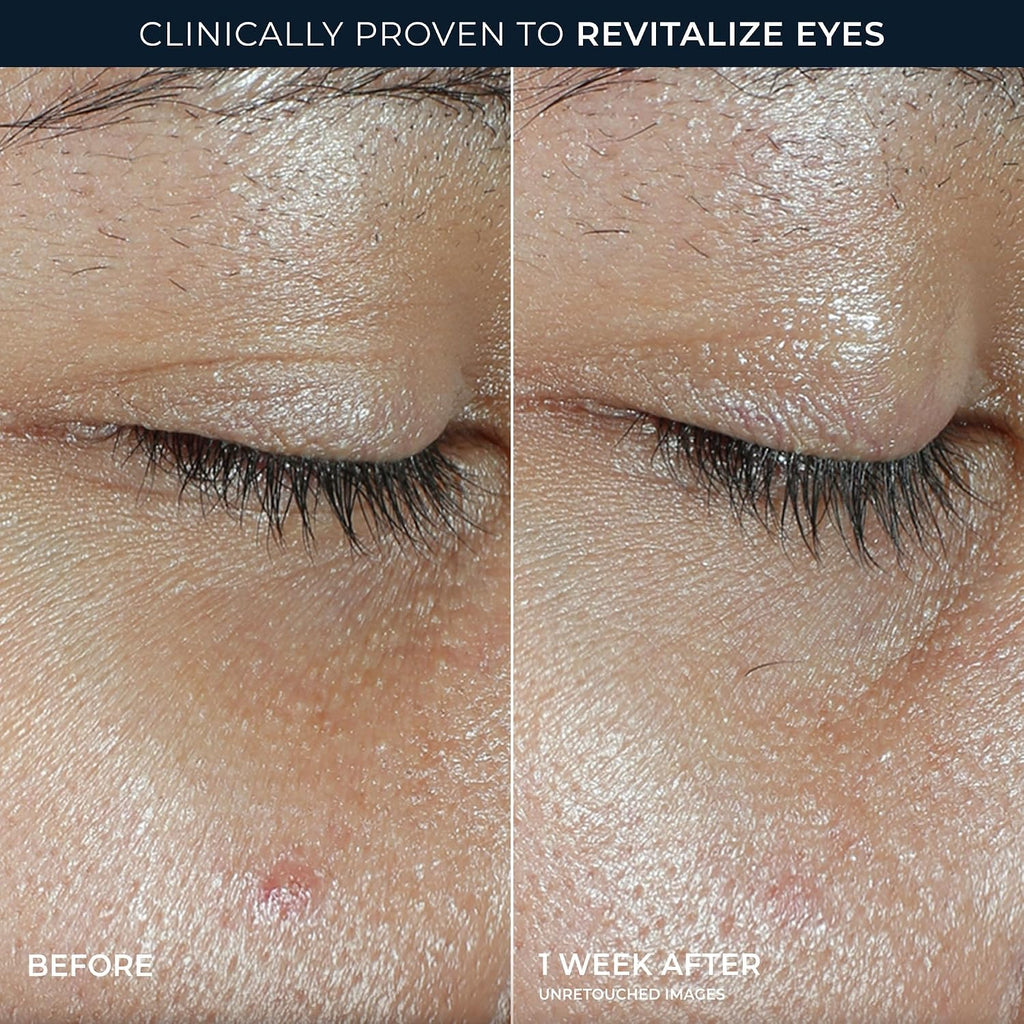 Multi Correxion Revive + Glow Eye Balm with Vitamin C (0.14 oz) + Retinol Eye Cream Packette (Packaging May Vary)