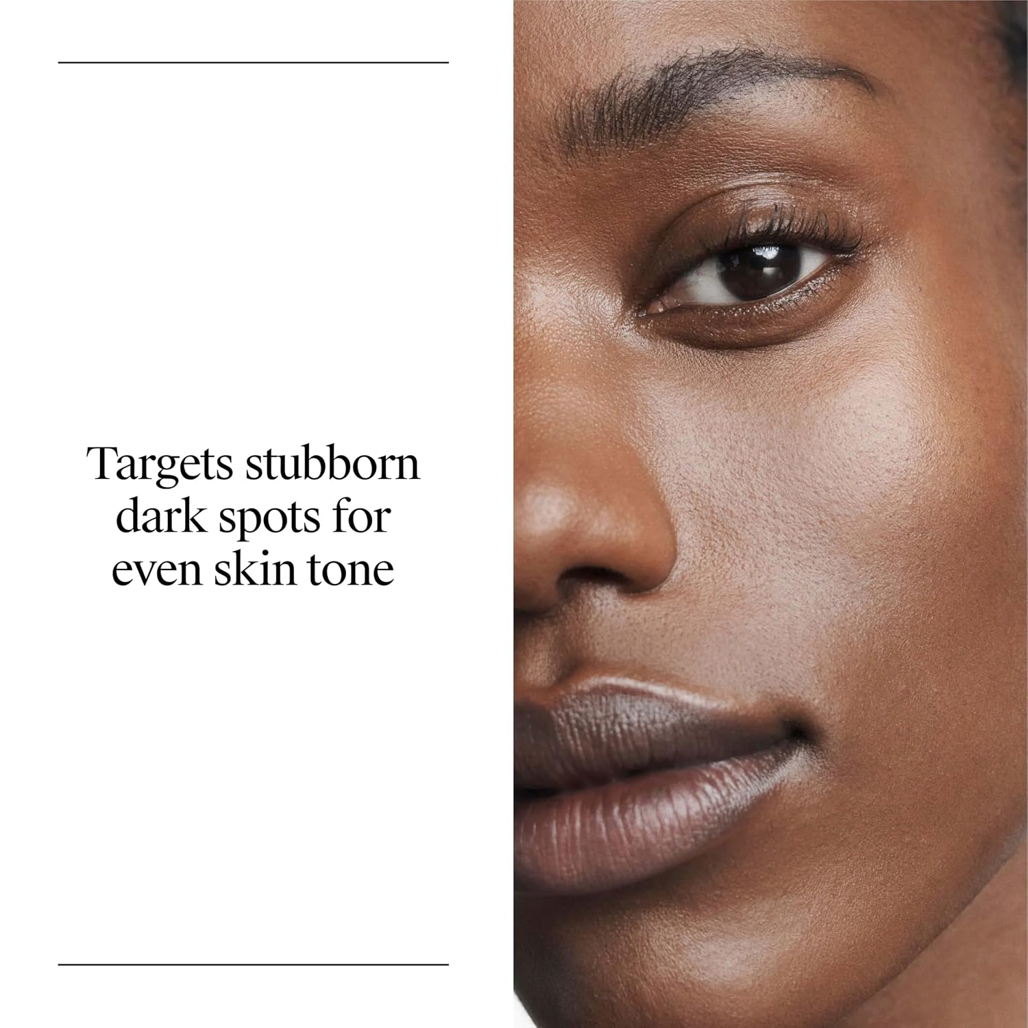 Neutrogena Rapid Tone Repair Retinol + Vitamin C Face Serum, 1 fl. oz | Retinol + Vitamin C, Dark Spot Corrector