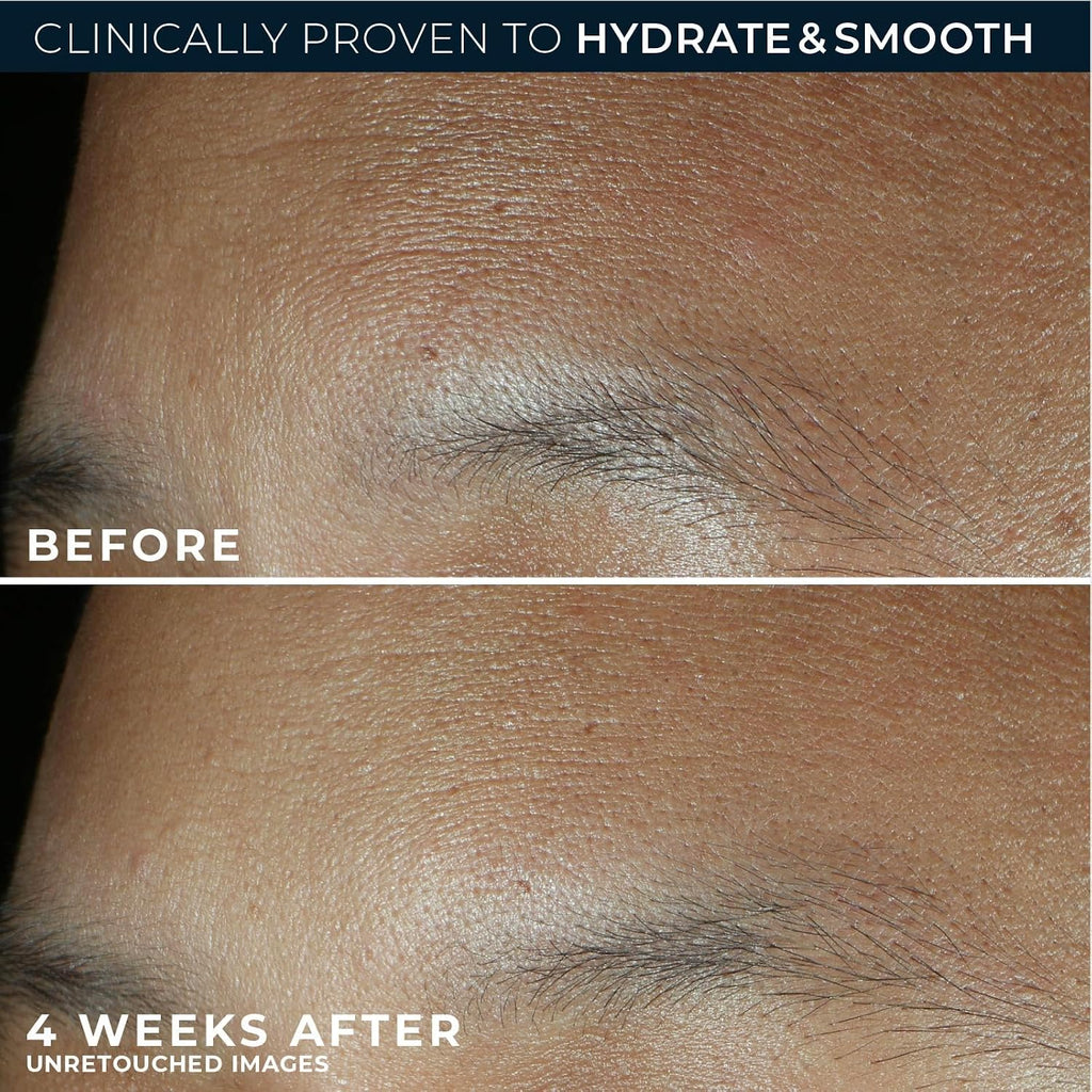 Retinol Correxion Max Hydration Anti-Aging Daily Face Moisturizer with Hyaluronic Acid, Fragrance-Free, Oil Free Skin