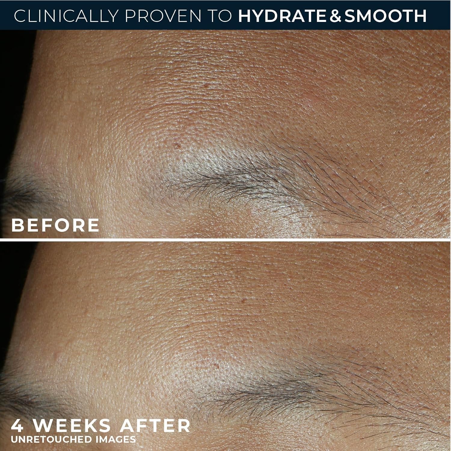 Retinol Correxion Max Hydration Anti-Aging Daily Face Moisturizer with Hyaluronic Acid, Fragrance-Free, Oil Free Skin