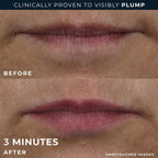 Derm Correxion Lip Volumizer, Hyaluronic Acid Lip Plumper Serum 0.34oz