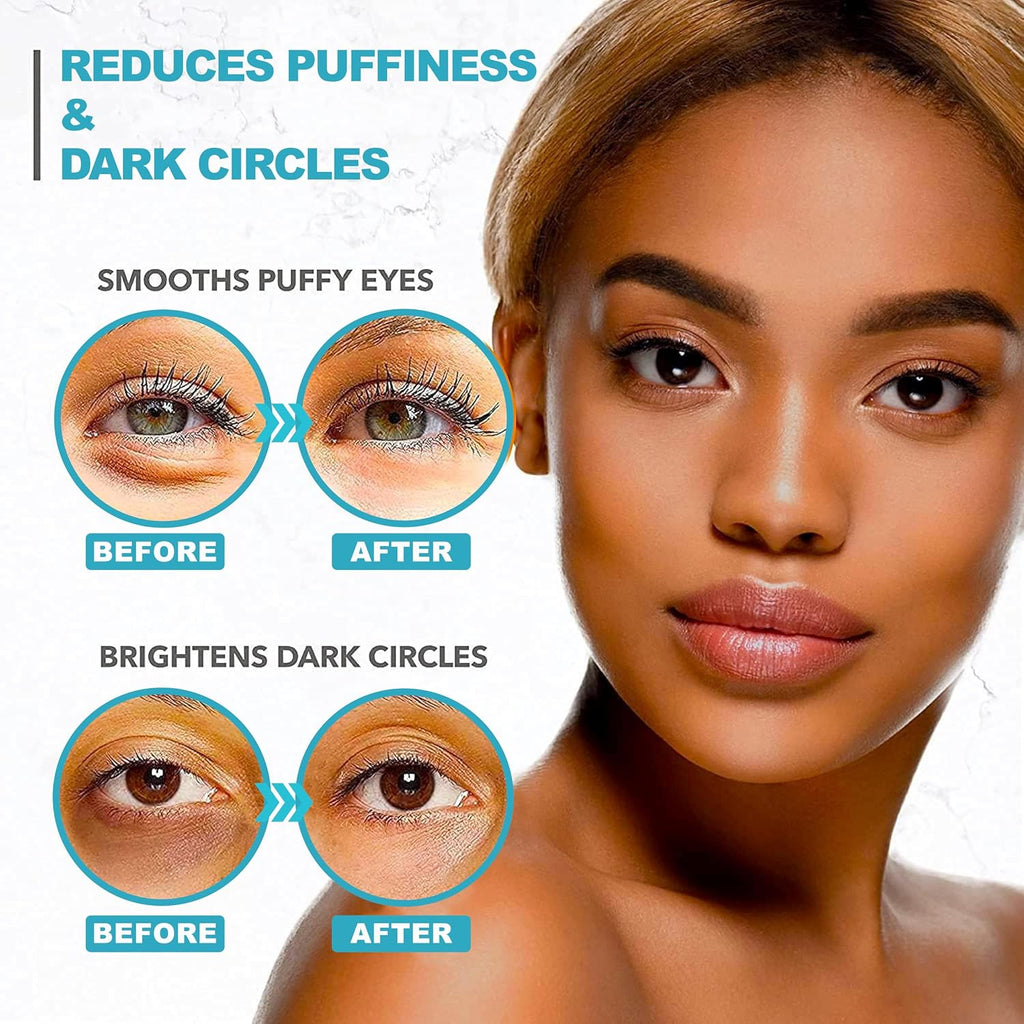 Under Eye Patches For Puffy Eyes And Dark Circles - Retinol Collagen Under Eye Masks - Reduce Wrinkles & Bags - Skin