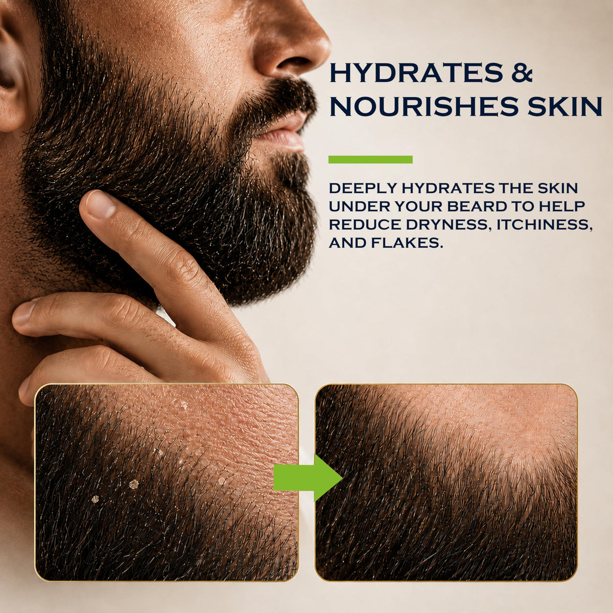 Beard Oil for Men, Cedar, Beard Conditioner Gift for Men