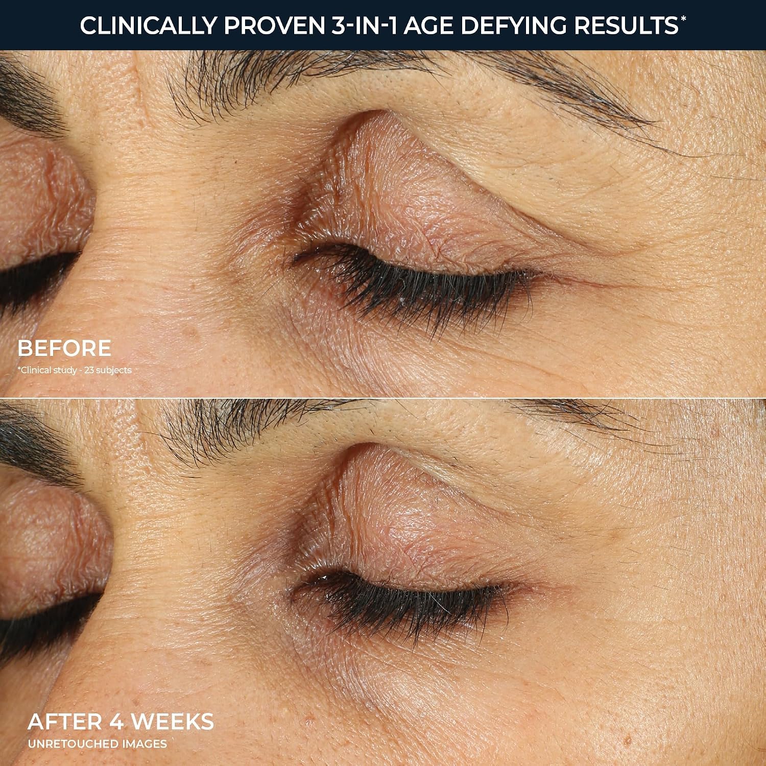 Retinol Correxion Under Eye Cream for Dark Circles & Puffiness, Daily Wrinkle Cream, Anti Aging Skin Care Treatment