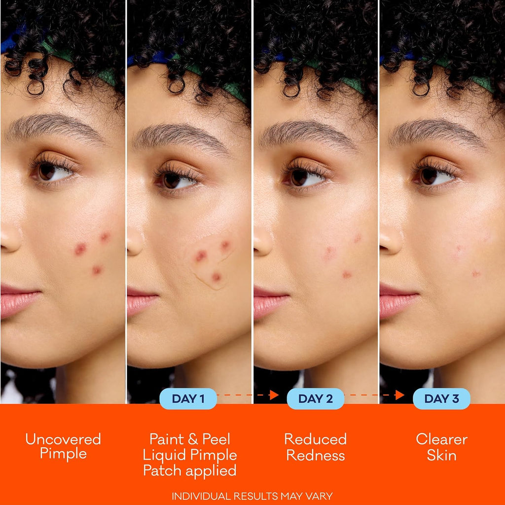 Biore Paint & Peel Liquid Pimple Patch Salicylic Acid Treatment, .5 fl oz | Invisible Acne Spot Treatment, Salicylic