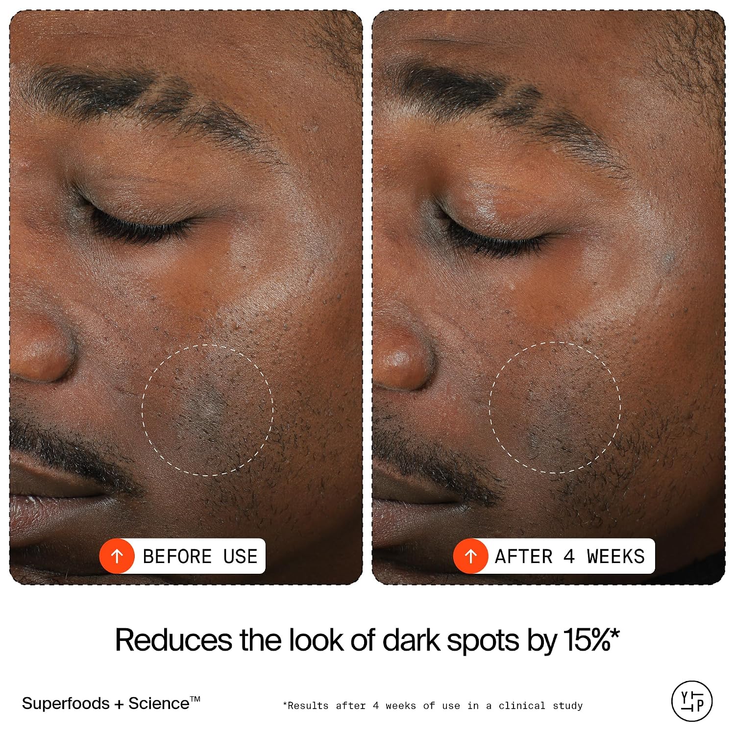 15% Vitamin C Bright Cell Face Serum (1 fl oz) | Brightening Facial Serum for Even Tone - Niacinamide + Adenosine +