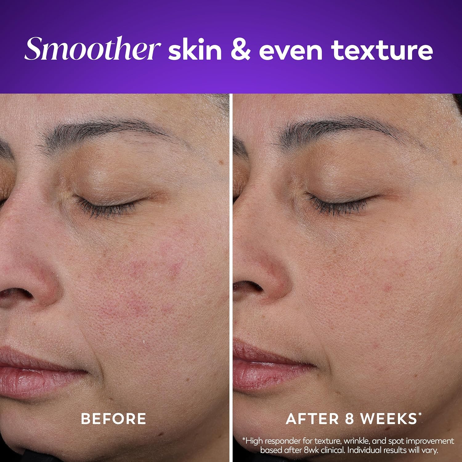 Retinol Night Cream for Women, Anti-Aging Face Moisturizer, Fragrance-Free, Non Greasy - Anti-Wrinkle, Smooth Fine
